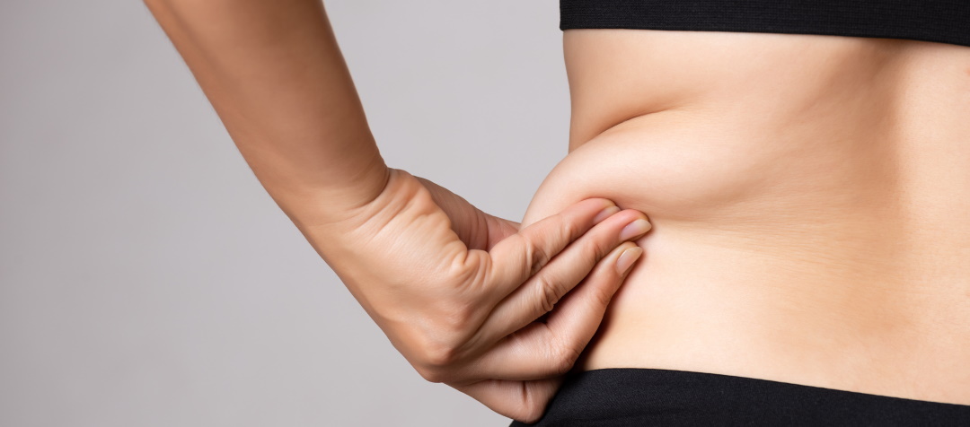How The CoolScultping Procedure Works to Reduce Fat