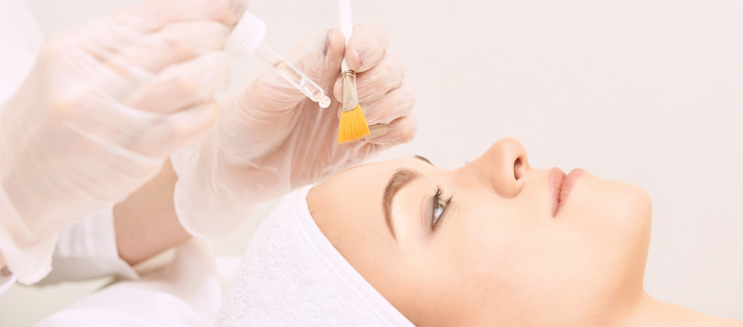 woman receiving chemical peel