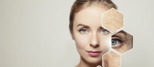 skin tightening treatments