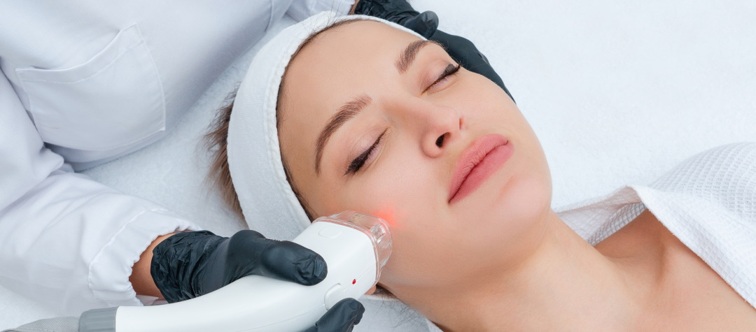 Lasers, Lights, Peels | Cosmetic Laser Light