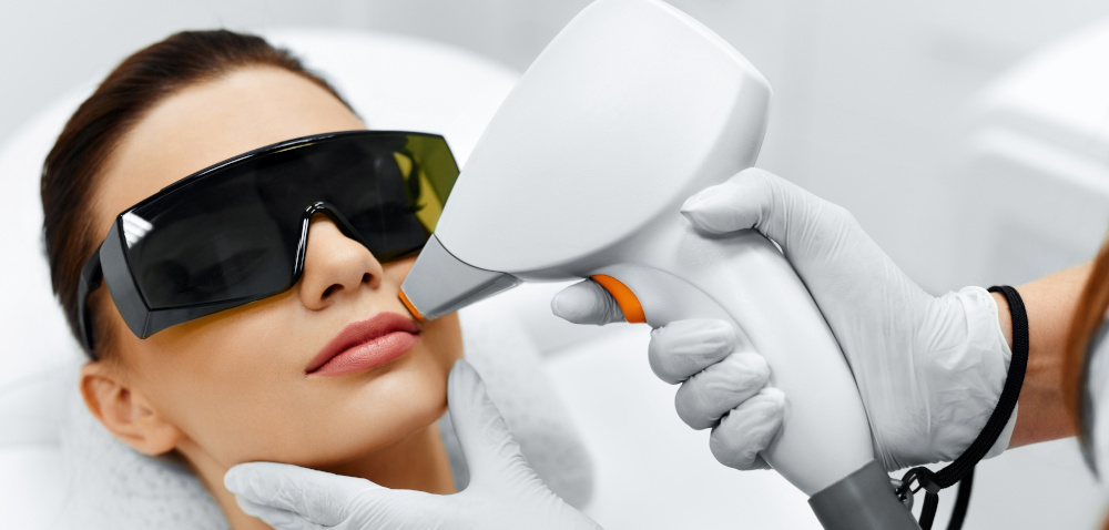 laser hair removal on face