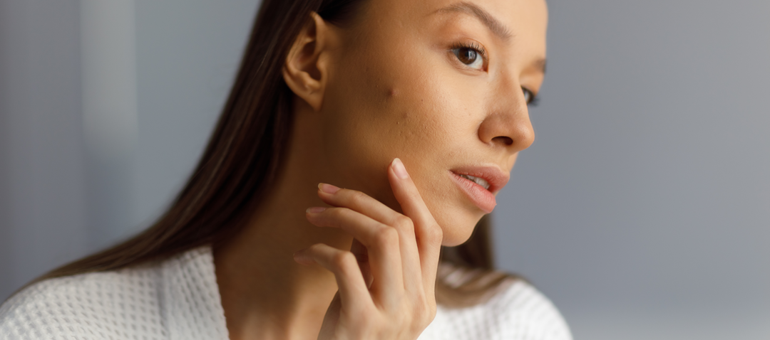 Reasons Your Skincare Products Aren’t Working and How Laser Treatments Can Help