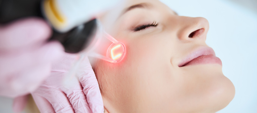laser skin face treatment